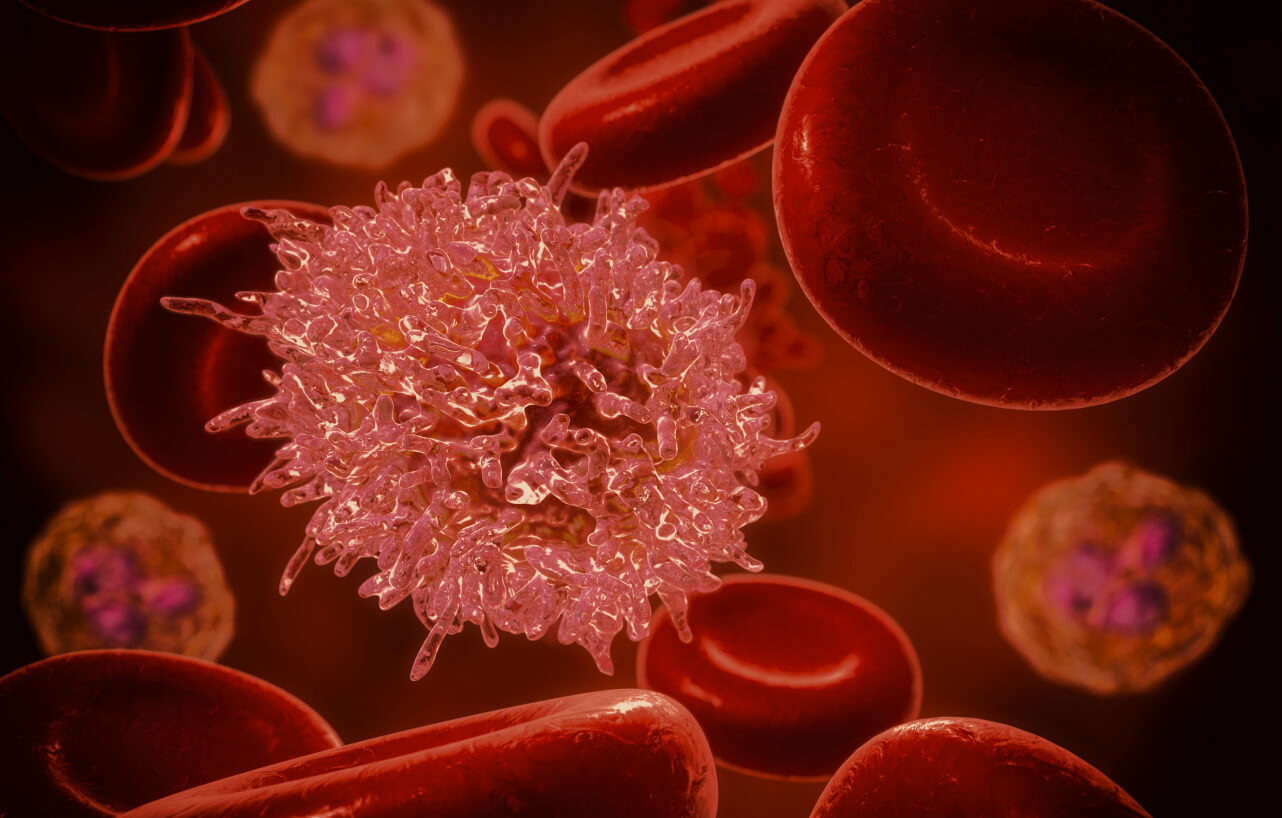 Oncoprecision